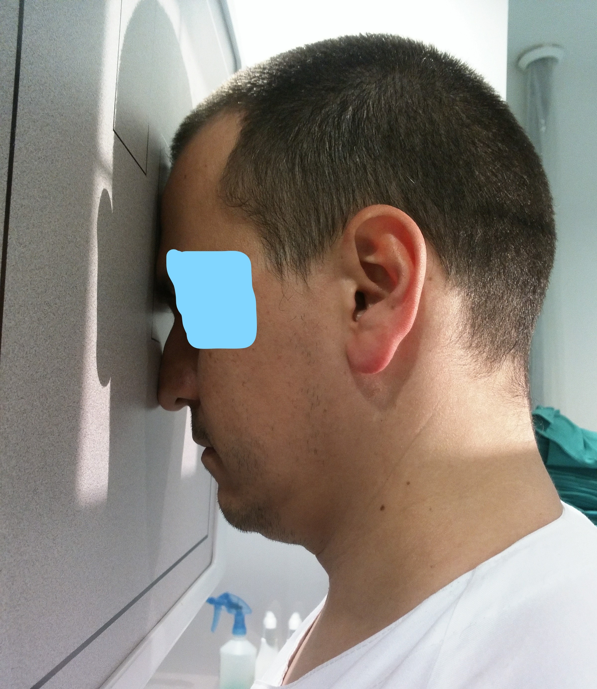 Posicionamiento PA Cráneo